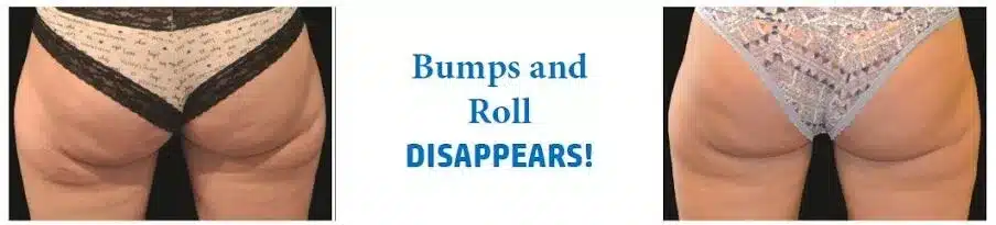 Bums and Roll Disappears