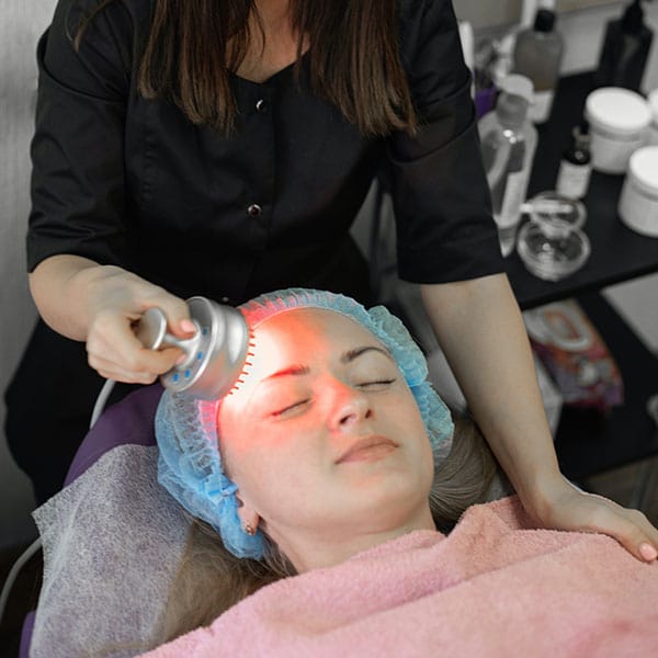 MicroLaser-Peel